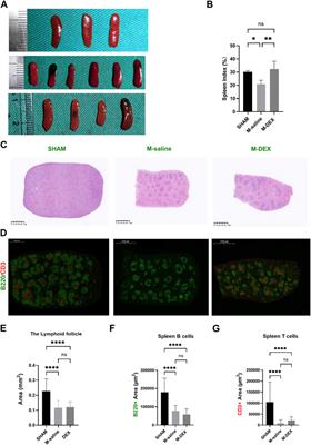 As an inhibitor of norepinephrine release, dexmedetomidine provides no improvement on stroke-associated pneumonia in mice